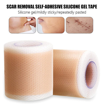 Dermoxy™ Scar Removal Tape